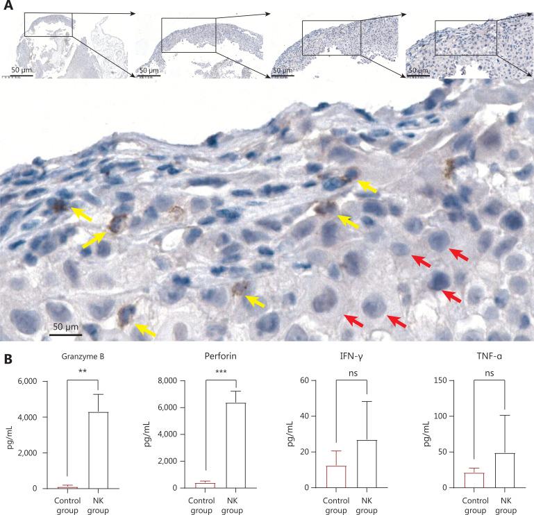 https://cdn.ncbi.nlm.nih.gov/pmc/blobs/9136/11667781/301f13067b7f/cbm-21-1078-g006.jpg