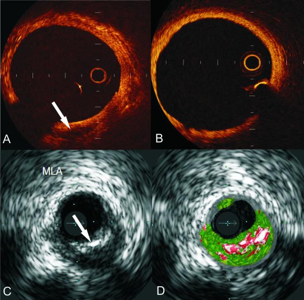 https://cdn.ncbi.nlm.nih.gov/pmc/blobs/9136/3039561/4cc7cb3b979e/1476-7120-9-2-1.jpg