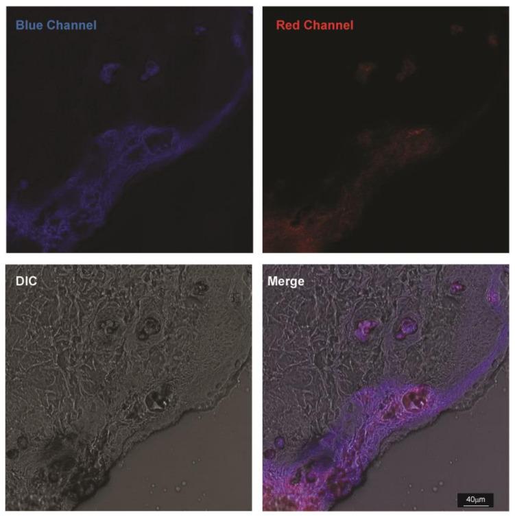 https://cdn.ncbi.nlm.nih.gov/pmc/blobs/913b/9138547/223eea5b8964/biomedicines-10-01070-g009.jpg