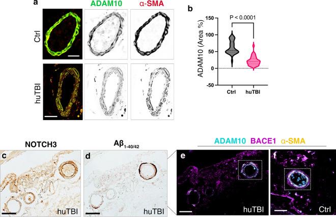 https://cdn.ncbi.nlm.nih.gov/pmc/blobs/9144/11754316/8c9c71424c8b/401_2025_2848_Fig5_HTML.jpg