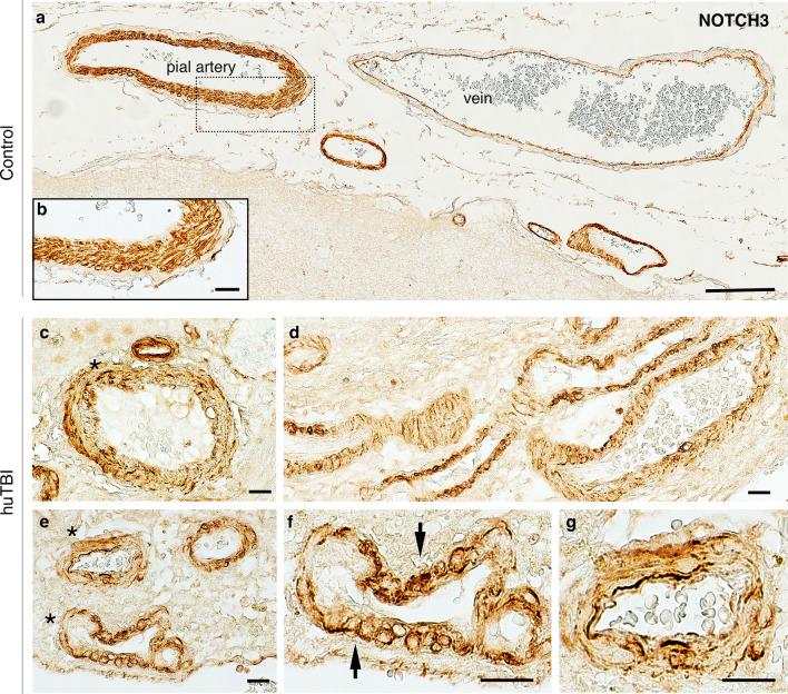 https://cdn.ncbi.nlm.nih.gov/pmc/blobs/9144/11754316/9bb255561d84/401_2025_2848_Fig1_HTML.jpg