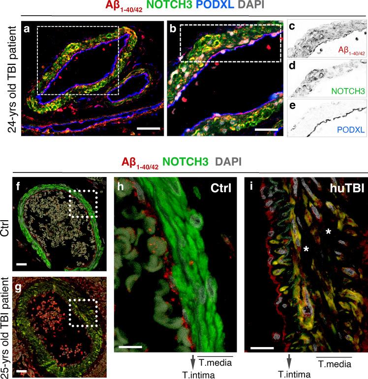 https://cdn.ncbi.nlm.nih.gov/pmc/blobs/9144/11754316/d7466fcd7d46/401_2025_2848_Fig4_HTML.jpg