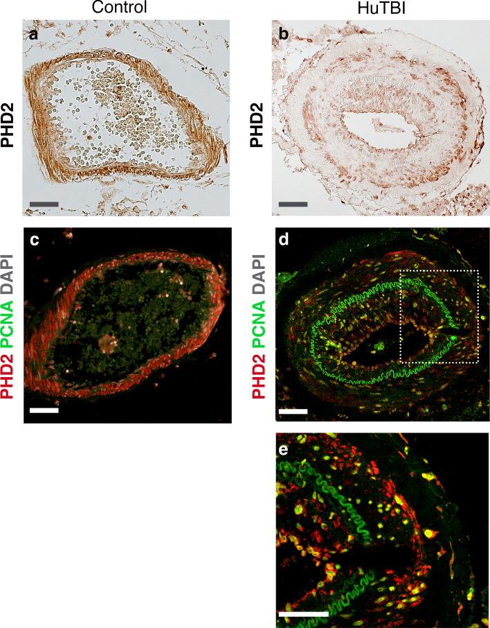 https://cdn.ncbi.nlm.nih.gov/pmc/blobs/9144/11754316/e96a21a60f66/401_2025_2848_Fig6_HTML.jpg