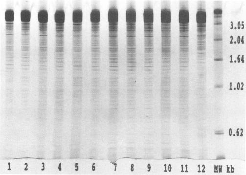 https://cdn.ncbi.nlm.nih.gov/pmc/blobs/914c/262634/2de281f94103/jcm00013-0148-b.jpg