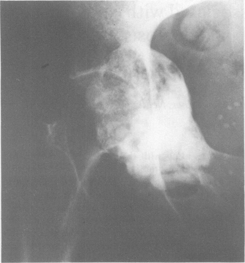 https://cdn.ncbi.nlm.nih.gov/pmc/blobs/9155/2426875/ad3ea94b4358/postmedj00165-0069-a.jpg