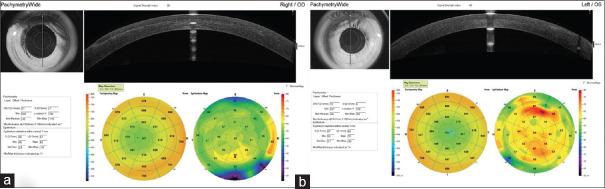 https://cdn.ncbi.nlm.nih.gov/pmc/blobs/9157/10433060/220f370ef1cb/OJO-16-329-g004.jpg