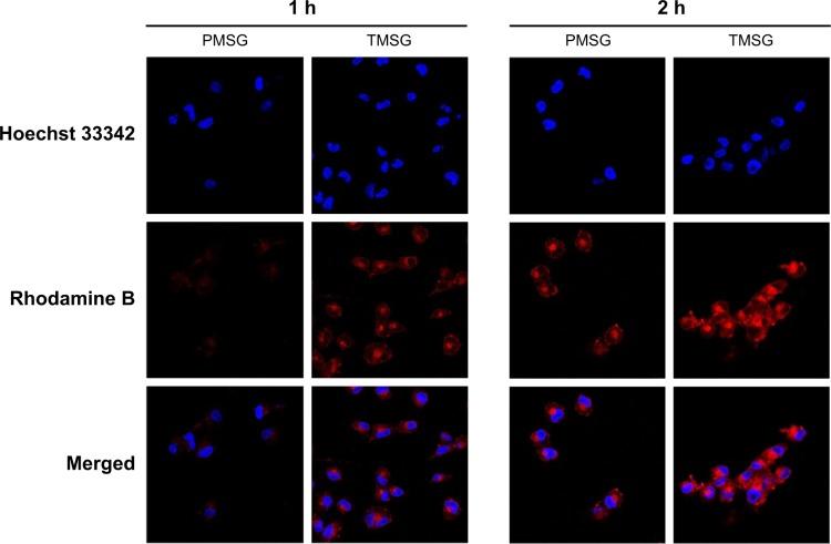 https://cdn.ncbi.nlm.nih.gov/pmc/blobs/9157/4524460/70bba7cc6d00/ijn-10-4747Fig7.jpg