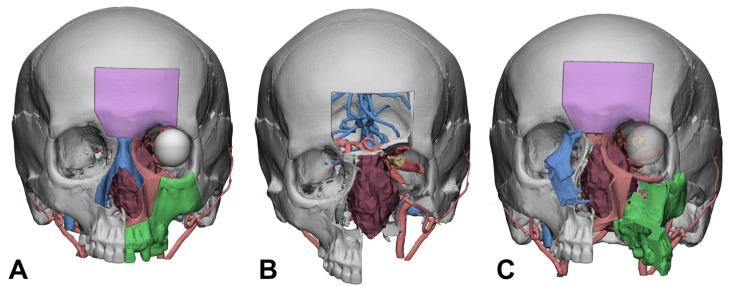 https://cdn.ncbi.nlm.nih.gov/pmc/blobs/9158/11171943/416b4ece4af4/diagnostics-14-01108-g001.jpg