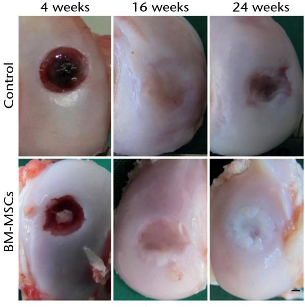 https://cdn.ncbi.nlm.nih.gov/pmc/blobs/915d/5331179/30e84e755509/bonejointres-06-98-g002.jpg