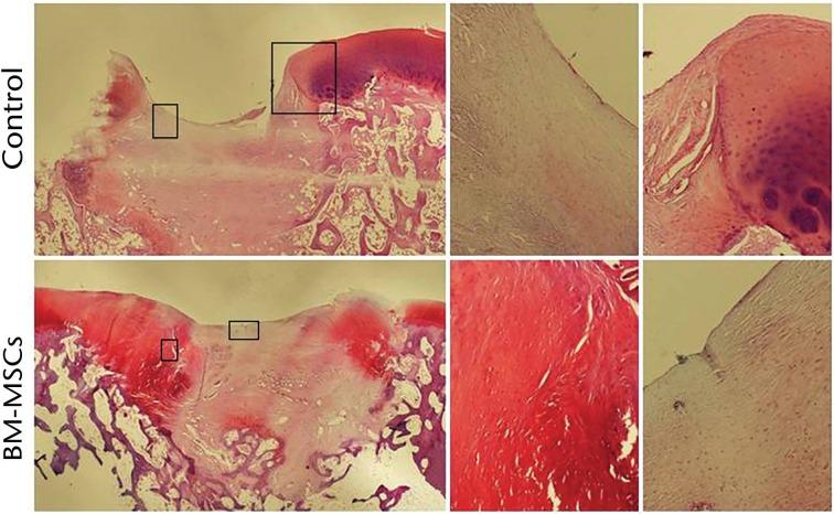 https://cdn.ncbi.nlm.nih.gov/pmc/blobs/915d/5331179/97a2903143f8/bonejointres-06-98-g006.jpg