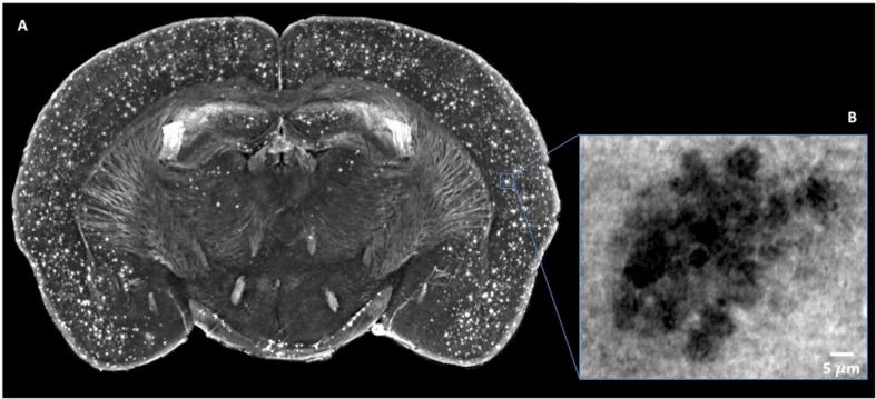 https://cdn.ncbi.nlm.nih.gov/pmc/blobs/915d/7680960/248cc727871d/fnins-14-584161-g006.jpg