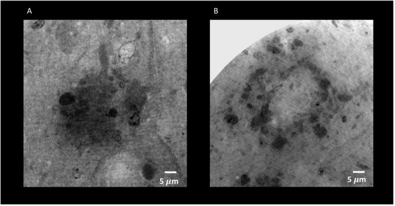 https://cdn.ncbi.nlm.nih.gov/pmc/blobs/915d/7680960/276f39079cd8/fnins-14-584161-g008.jpg