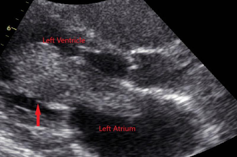 https://cdn.ncbi.nlm.nih.gov/pmc/blobs/9163/7489787/4309d9905b45/cureus-0012-00000009745-i01.jpg