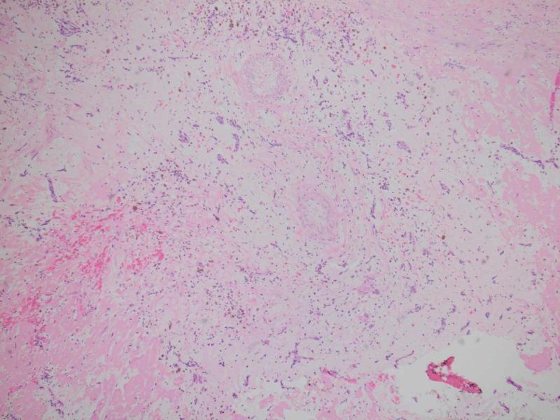 https://cdn.ncbi.nlm.nih.gov/pmc/blobs/9163/7489787/c310916cedb6/cureus-0012-00000009745-i05.jpg