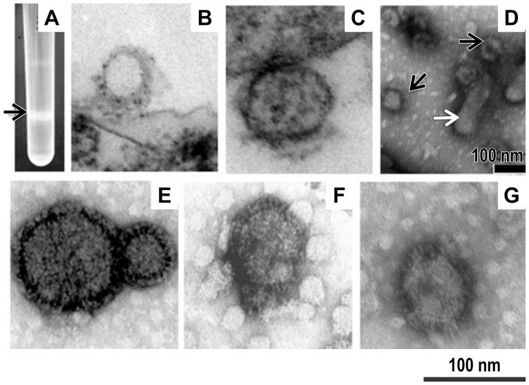 https://cdn.ncbi.nlm.nih.gov/pmc/blobs/9166/4130610/a0ac4dd493bc/pone.0104791.g002.jpg