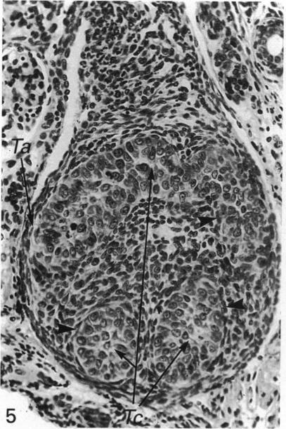 https://cdn.ncbi.nlm.nih.gov/pmc/blobs/9175/1259852/8f09de60b7b8/janat00141-0045-b.jpg