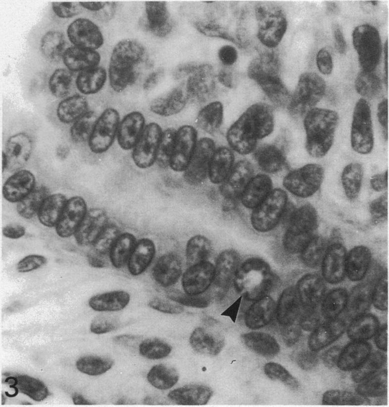 https://cdn.ncbi.nlm.nih.gov/pmc/blobs/9175/1259852/94d0149d4604/janat00141-0044-c.jpg