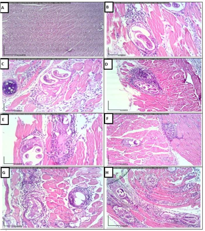 https://cdn.ncbi.nlm.nih.gov/pmc/blobs/9177/12274003/e7ee46fff21b/pntd.0013239.g010.jpg