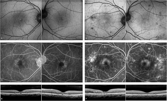 https://cdn.ncbi.nlm.nih.gov/pmc/blobs/9181/10936077/dfa15d039181/40942_2024_545_Fig1_HTML.jpg