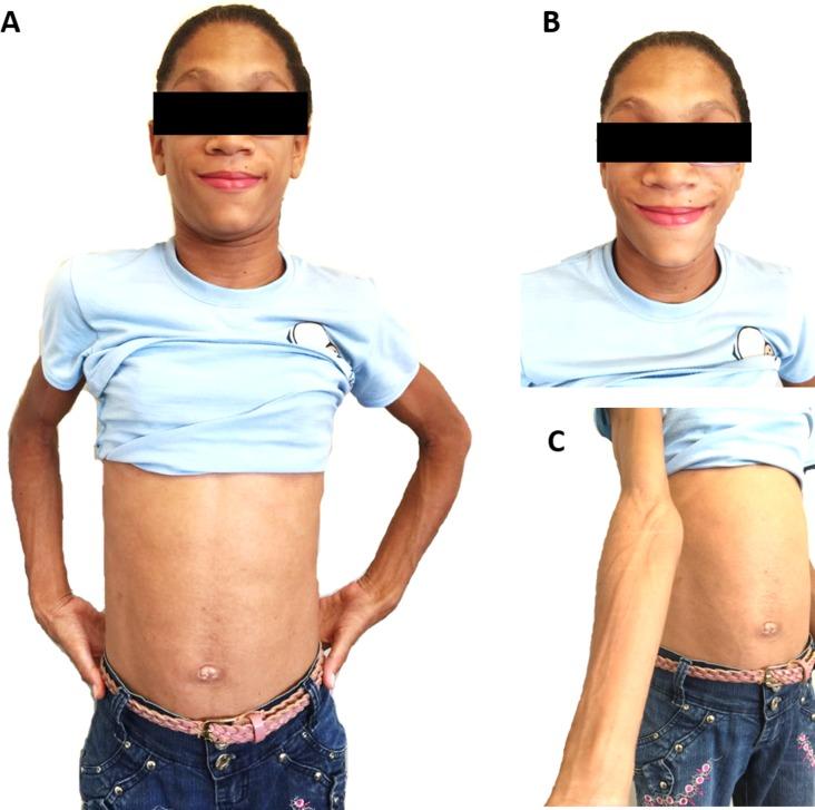 https://cdn.ncbi.nlm.nih.gov/pmc/blobs/9188/5986131/1381e8e04d1b/pone.0197784.g002.jpg
