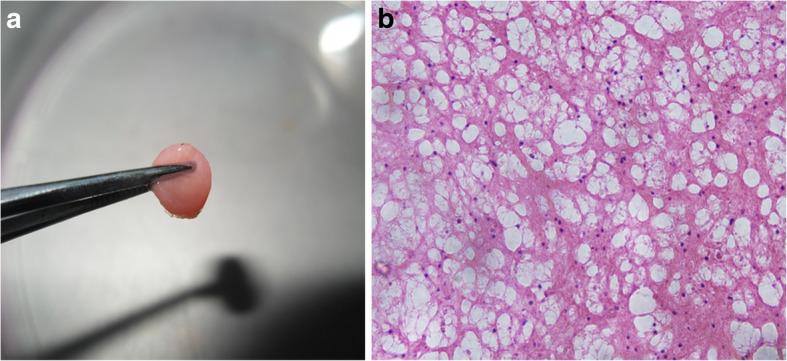 https://cdn.ncbi.nlm.nih.gov/pmc/blobs/9190/7414651/f7db5abd477e/13018_2020_1840_Fig2_HTML.jpg