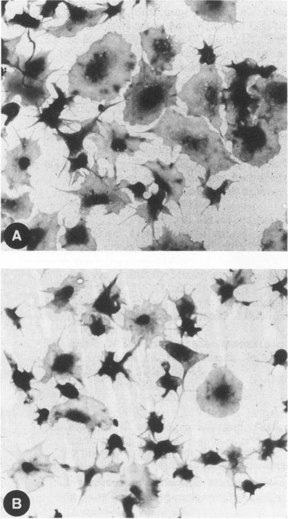 https://cdn.ncbi.nlm.nih.gov/pmc/blobs/9192/1887224/057e02442169/amjpathol00069-0185-a.jpg