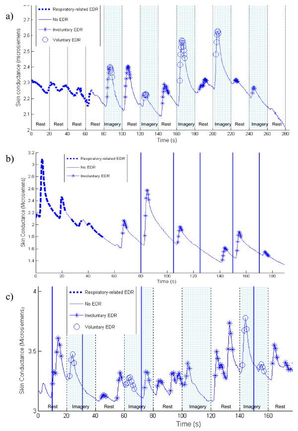 https://cdn.ncbi.nlm.nih.gov/pmc/blobs/9192/2851698/4655ad709ff8/1475-925X-9-11-4.jpg