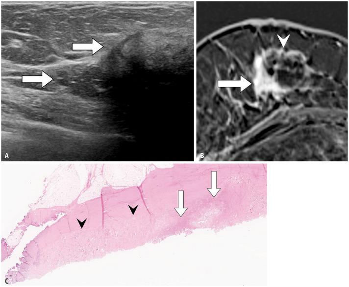 https://cdn.ncbi.nlm.nih.gov/pmc/blobs/9199/11524691/06ae7ce32626/kjr-25-992-g005.jpg