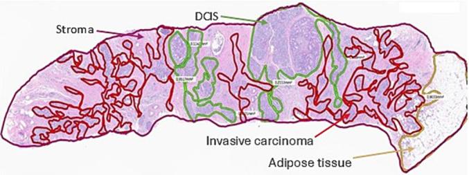 https://cdn.ncbi.nlm.nih.gov/pmc/blobs/91a2/12155861/60f46047f67f/gr1.jpg