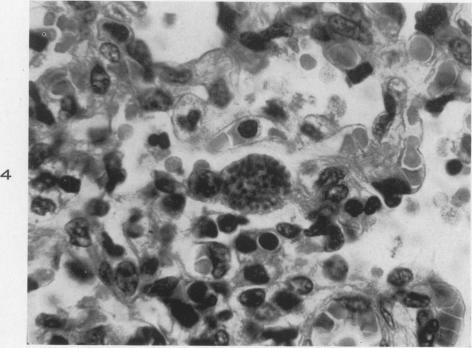 https://cdn.ncbi.nlm.nih.gov/pmc/blobs/91a8/1934247/331bd363a16d/amjpathol00507-0130-b.jpg