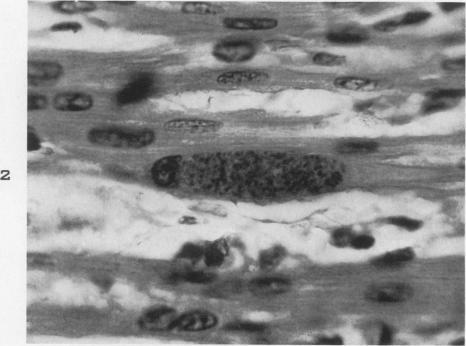 https://cdn.ncbi.nlm.nih.gov/pmc/blobs/91a8/1934247/e994ba262f4d/amjpathol00507-0128-b.jpg