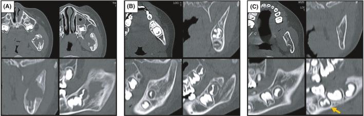 https://cdn.ncbi.nlm.nih.gov/pmc/blobs/91ac/8223692/59293da44f00/CCR3-9-e04321-g001.jpg