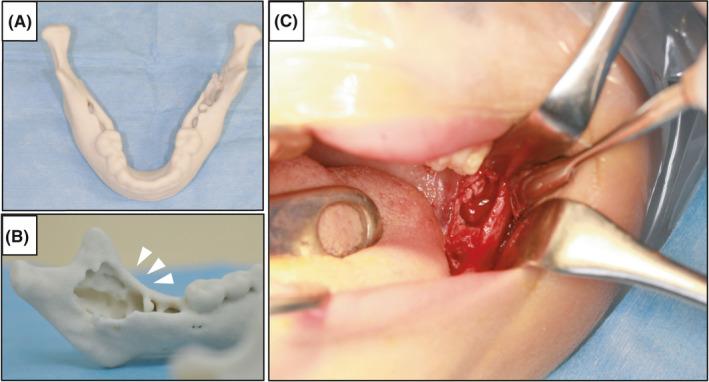 https://cdn.ncbi.nlm.nih.gov/pmc/blobs/91ac/8223692/ed6596bbe644/CCR3-9-e04321-g005.jpg