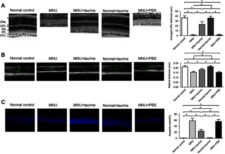 https://cdn.ncbi.nlm.nih.gov/pmc/blobs/91ae/6689665/ba8065ba66d2/DDDT-13-2689-g0002.jpg