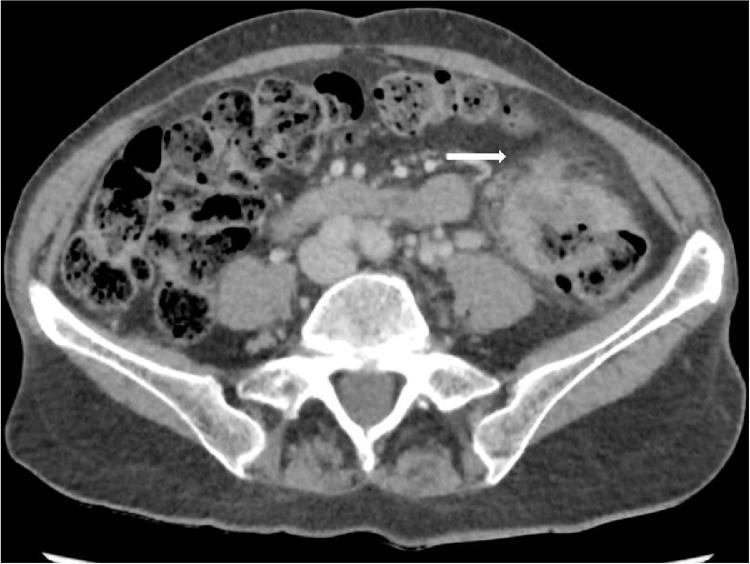 https://cdn.ncbi.nlm.nih.gov/pmc/blobs/91b1/6994830/a67d6d0b3034/gr1.jpg