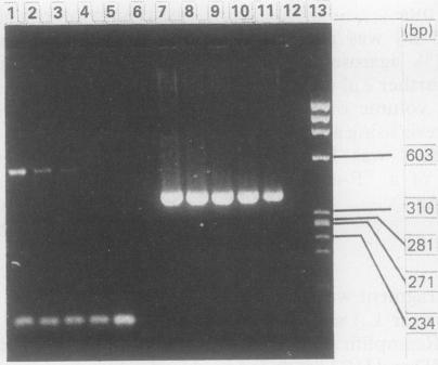 https://cdn.ncbi.nlm.nih.gov/pmc/blobs/91b3/496909/8540bfeb08a3/jclinpath00406-0060-a.jpg