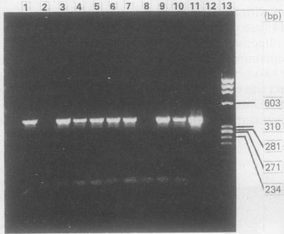 https://cdn.ncbi.nlm.nih.gov/pmc/blobs/91b3/496909/b1027717317c/jclinpath00406-0060-b.jpg