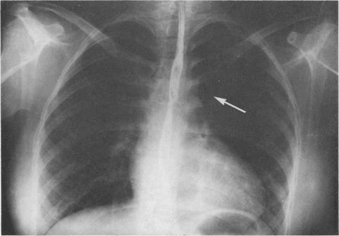https://cdn.ncbi.nlm.nih.gov/pmc/blobs/91bd/287454/26c3691b2500/cardiodis00028-0019-a.jpg