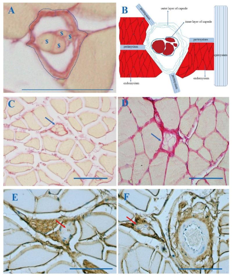 https://cdn.ncbi.nlm.nih.gov/pmc/blobs/91bf/8745670/14e0a79dbc91/jcm-11-00086-g002.jpg