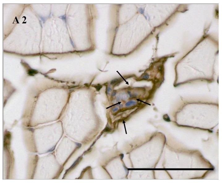https://cdn.ncbi.nlm.nih.gov/pmc/blobs/91bf/8745670/da9875f3445e/jcm-11-00086-g0A2.jpg