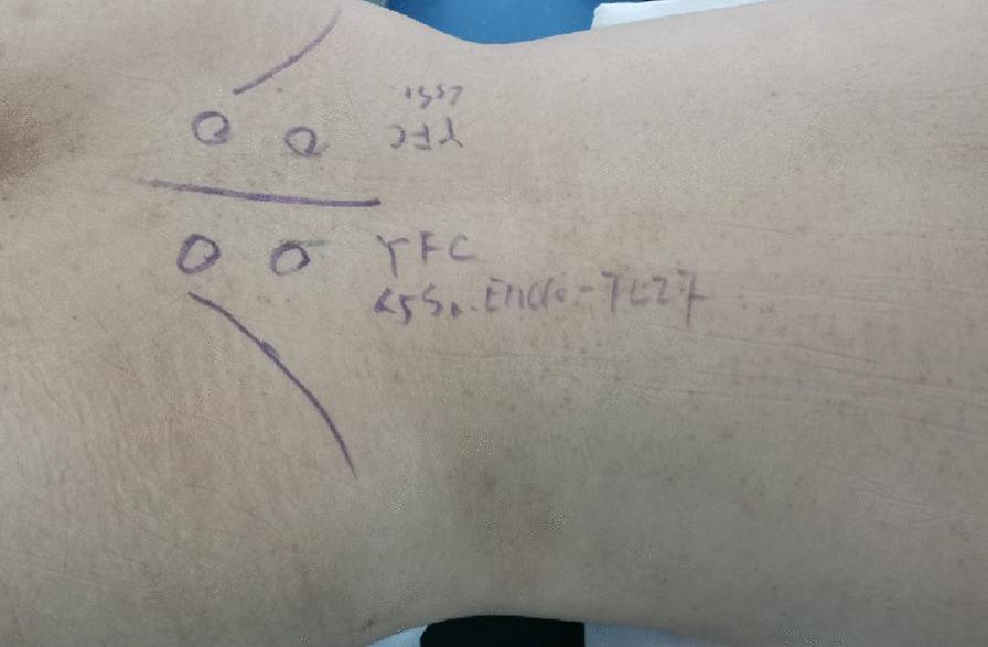 https://cdn.ncbi.nlm.nih.gov/pmc/blobs/91ca/7981827/bfbc35e1a7a6/12893_2021_1148_Fig2_HTML.jpg