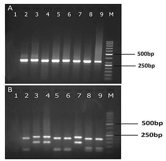 https://cdn.ncbi.nlm.nih.gov/pmc/blobs/91cf/6091798/ca0c9f4f6b83/JAD-12-162-g002.jpg