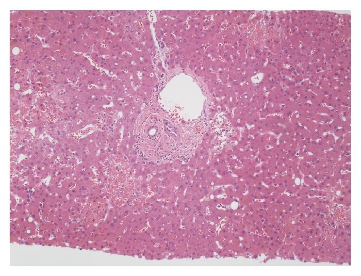 https://cdn.ncbi.nlm.nih.gov/pmc/blobs/91d7/6180957/4136828492d9/CRIHEP2018-1269340.008.jpg