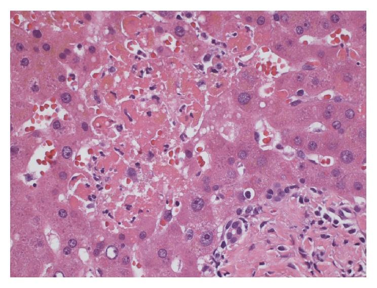 https://cdn.ncbi.nlm.nih.gov/pmc/blobs/91d7/6180957/81d0301f84d9/CRIHEP2018-1269340.006.jpg