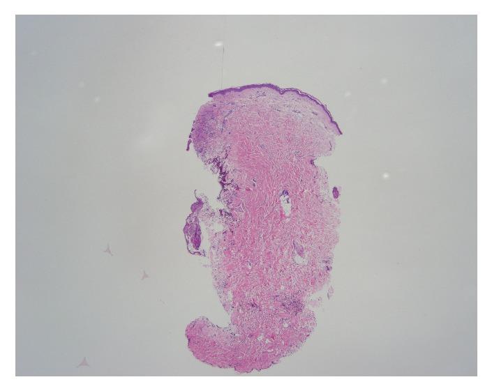 https://cdn.ncbi.nlm.nih.gov/pmc/blobs/91d7/6180957/97dd4cef64c0/CRIHEP2018-1269340.003.jpg
