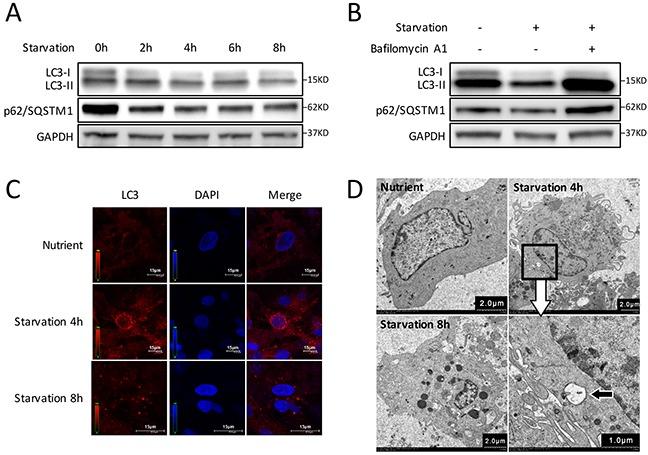 https://cdn.ncbi.nlm.nih.gov/pmc/blobs/91db/5609964/046509846f4c/oncotarget-08-63825-g001.jpg