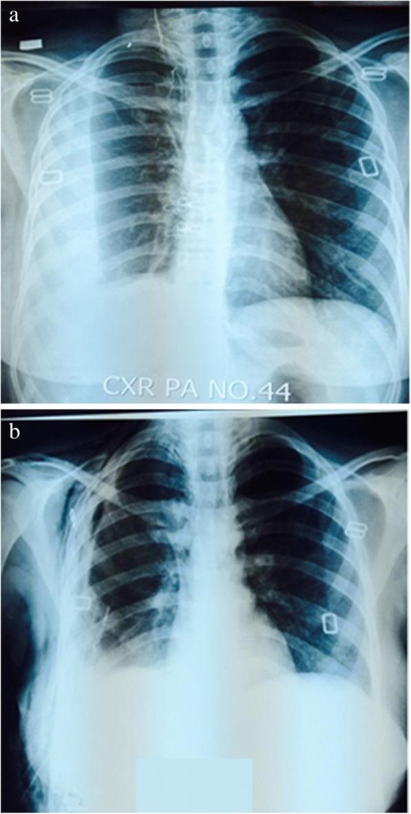 https://cdn.ncbi.nlm.nih.gov/pmc/blobs/91df/6264615/9613e6bfa0a8/12890_2018_745_Fig5_HTML.jpg