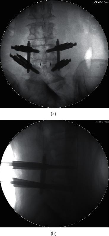 https://cdn.ncbi.nlm.nih.gov/pmc/blobs/91e8/8712165/975c0a02f177/PRM2021-6894001.004.jpg
