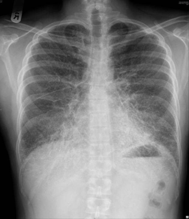 https://cdn.ncbi.nlm.nih.gov/pmc/blobs/91e9/4184723/83bbcb585131/rcr20002-0018-f1.jpg