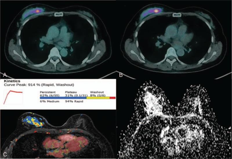 https://cdn.ncbi.nlm.nih.gov/pmc/blobs/91ed/5626137/ccf84e4513e1/medi-96-e7657-g009.jpg